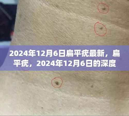 扁平疣深度观察,回顾与影响分析