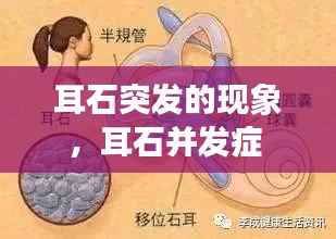 耳石突发的现象,耳石并发症