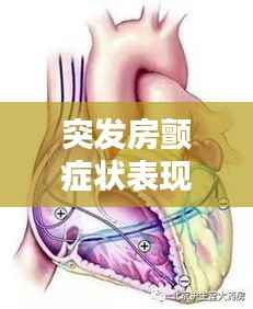 突发房颤症状表现,突发性房颤的临床症状