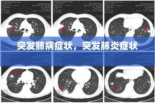 突发肺病症状,突发肺炎症状